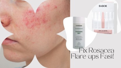 An image of a woman with rosacea next to pictures of products designed to treat it with text that reads 'Fix Rosacea Flare-ups Fast!'