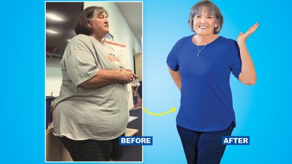 Before and after photographs showing a woman who lost 207 lbs