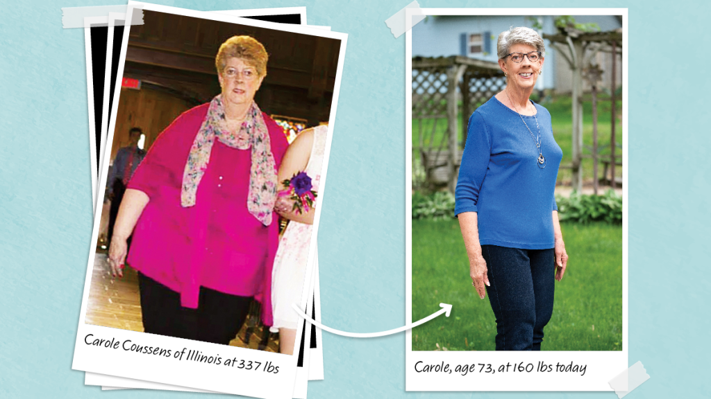 Before and after of Carole Coussens, age 73, who lost 177 lbs with skinny syrups