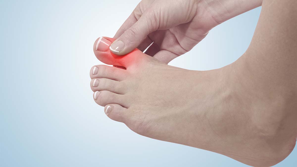 Treatment for Big Toe Joint Pain Foot Arthritis