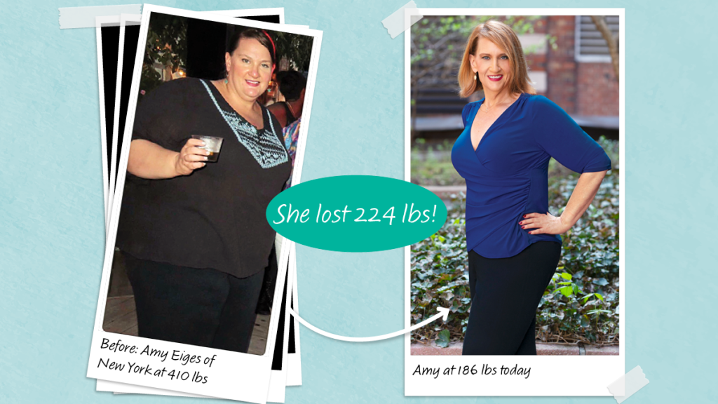 Before and after of Amy Eiges who lost 224 lbs with a burger trick that stopped her from being hungry on keto