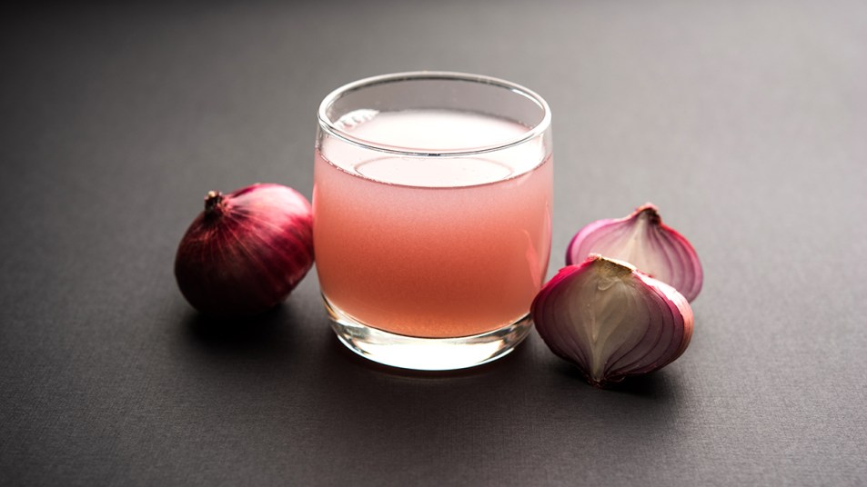 onion juice to help treat hair loss