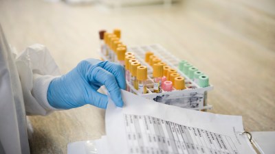 New Alzheimer’s Test Shows 90% Accuracy in Diagnosing Early-Stage Dementia: Here’s When to Get It