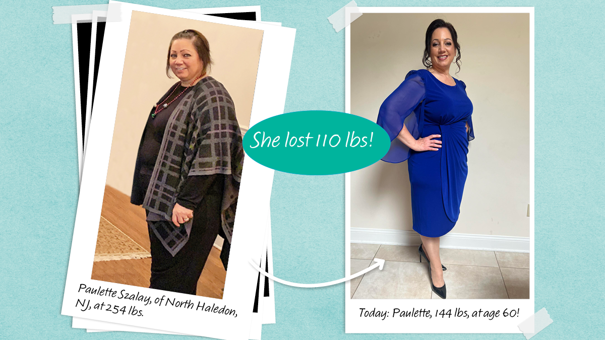 Paulette Szalay survived a stroke