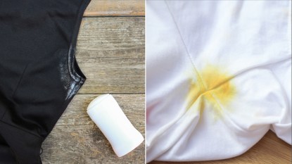 white and yellow deodorant stains on clothes
