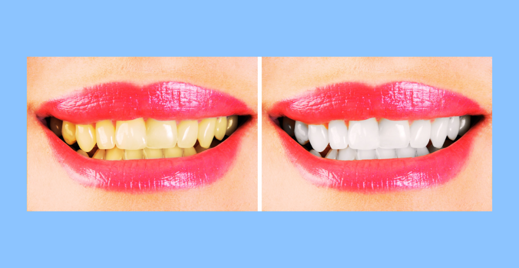 Dentatur