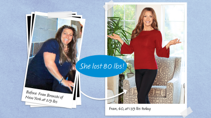 Before and after photos of Fran Bronski, who learned how to use coconut oil to lose weight and dropped 80 lbs