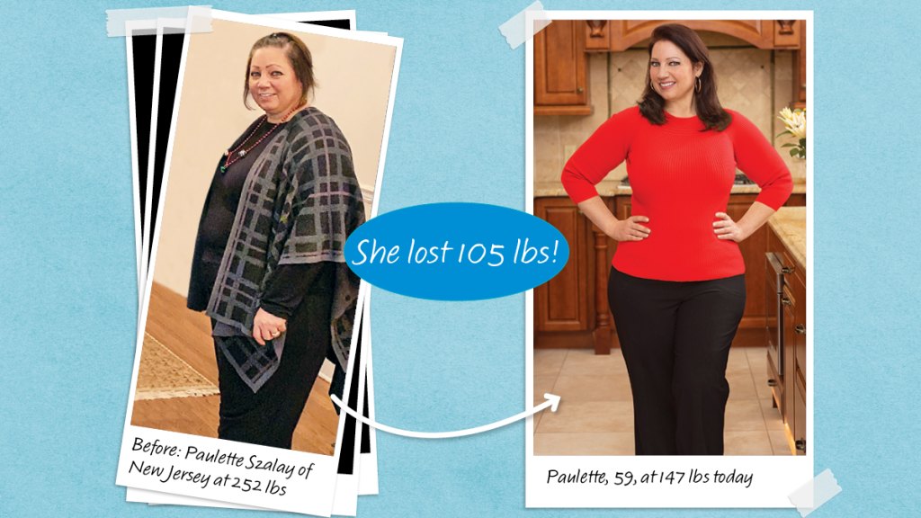 Before and after photos of Paulette Szalay who lost 105 lbs using ashwagandha for weight loss