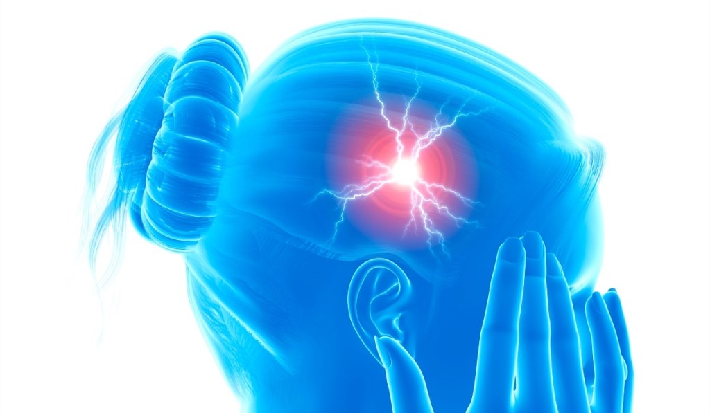 An illustration of a migraine, which can be treated with self-care remedies