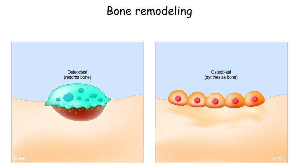 An illustration of bone cells and bone remodeling