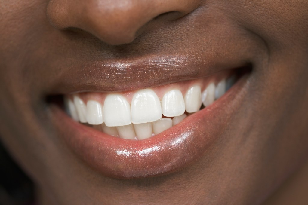 Close up of woman's smile with whitened teeth