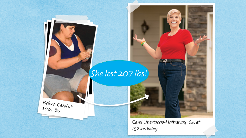 Before and after photos of Carol Ubertaccio-Hathaway, who lost 207 lbs with exogenous ketones