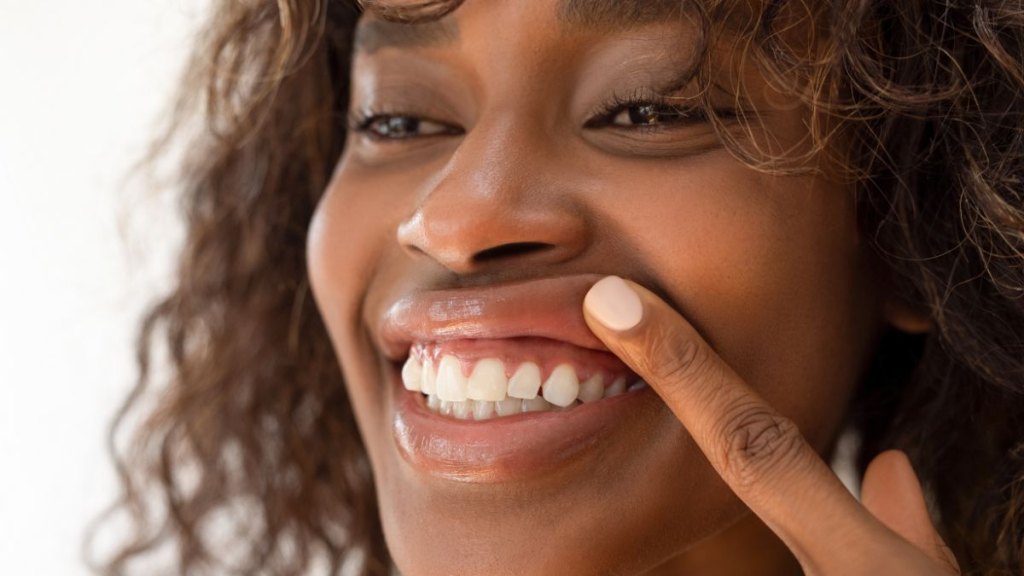 Bee ‘glue’ alleviates tooth sensitivity 