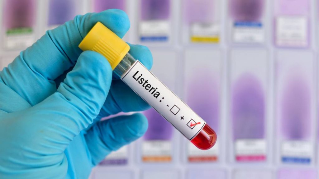 Listeria Infection