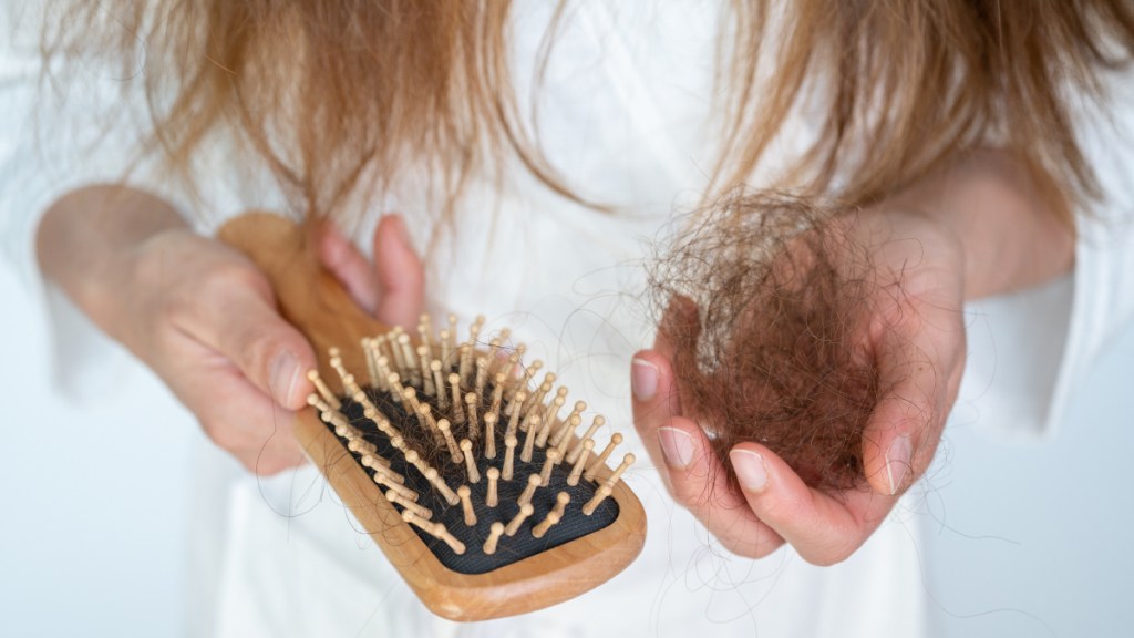 A close up of a woman holding a brush and a clump of hair caused by hair loss