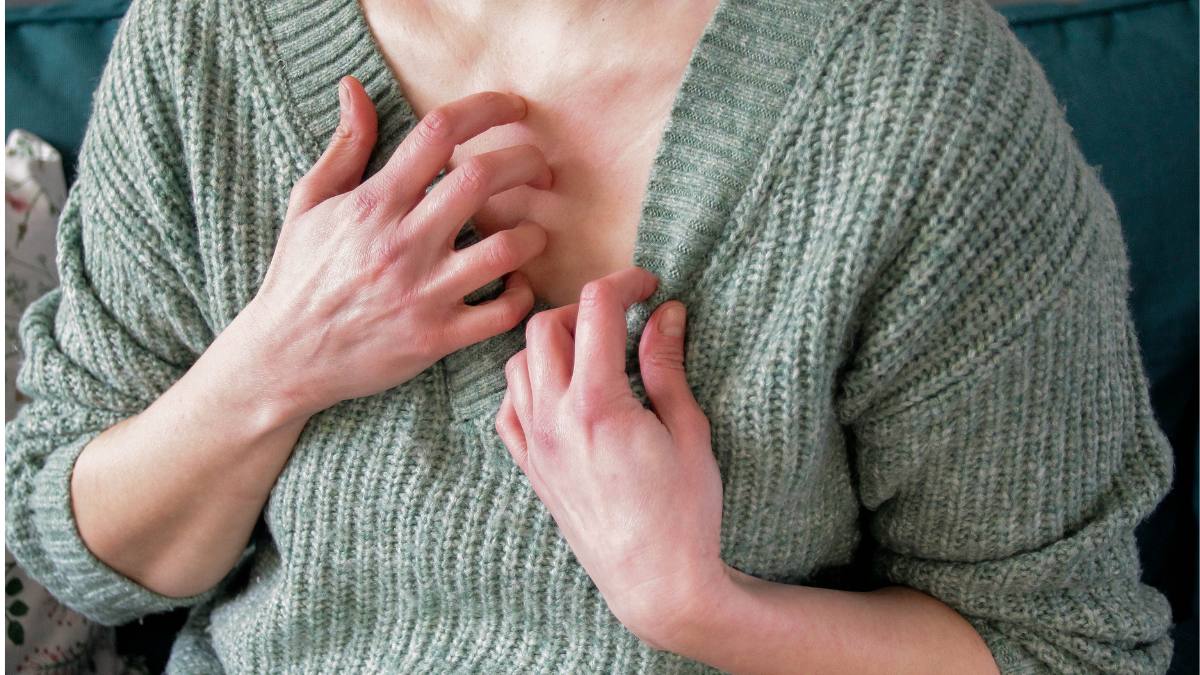 Woman with irritated skin