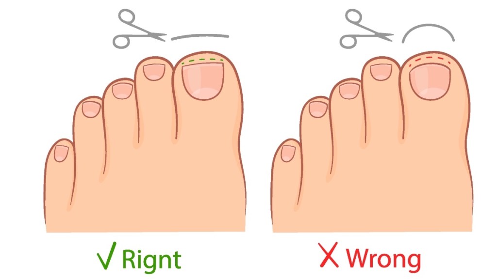 An illustration of how to trim your toenails