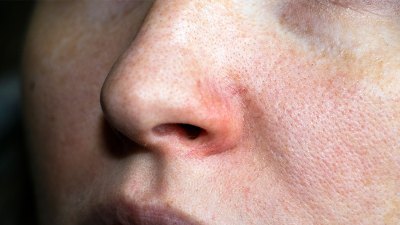 How To Get Rid of Textured Skin, According To Skin Pros Woman's World