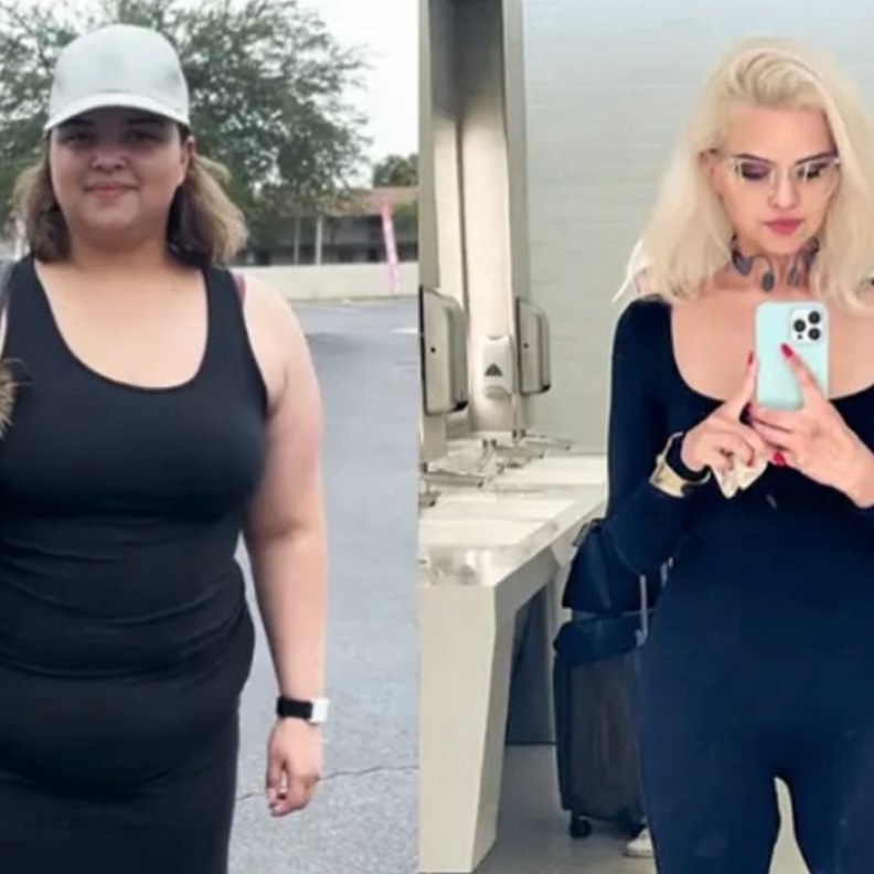 Nicole Velez before and after