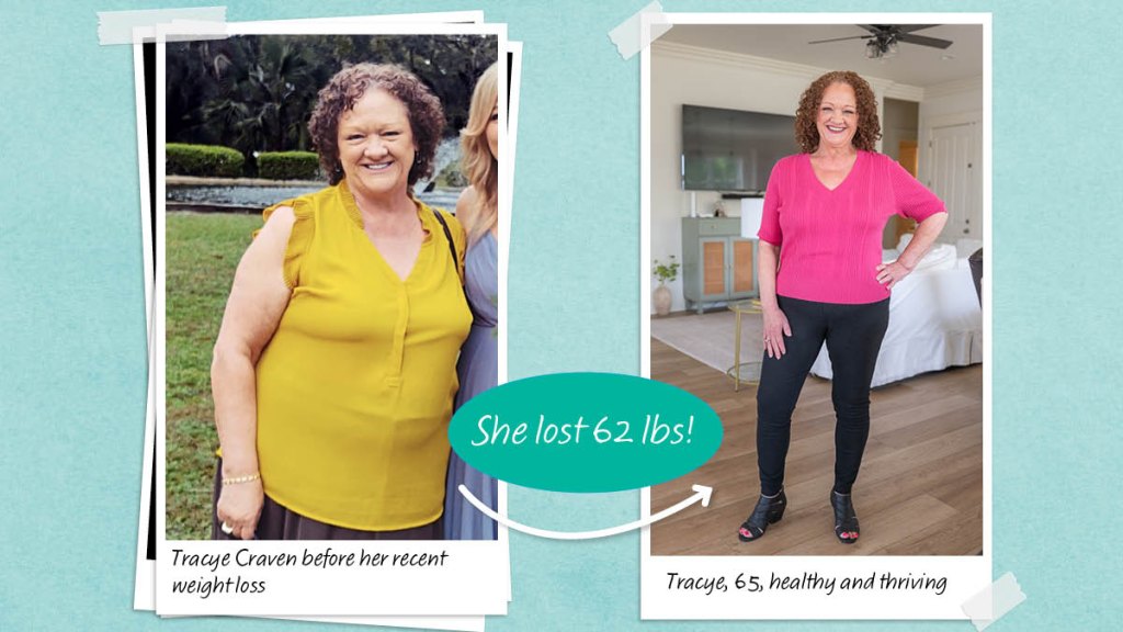 Tracye Craven before and after losing 62 pounds on a diet for a fatty liver