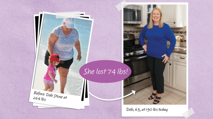 Before and after photos of Deb Stone who lost 74 lbs by walking off weight