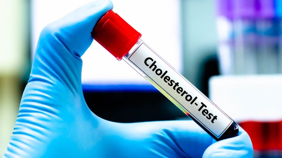 cholesterol levels by age chart