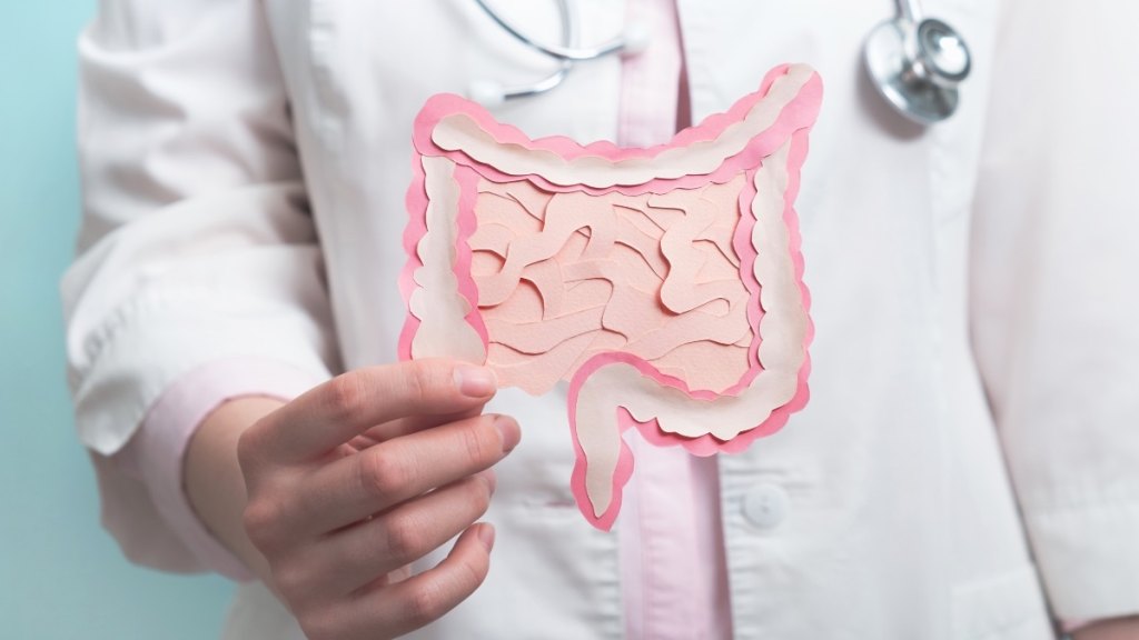 A doctor holding up an illustration of a gut microbiome, which can impact Alzheimer's risk