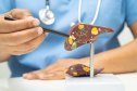A close-up of a doctor pointing to a model of a liver with liver disease