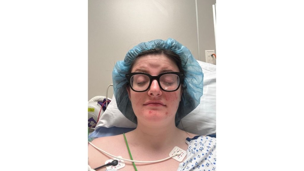 Carissa Mosness after her first double vision surgery