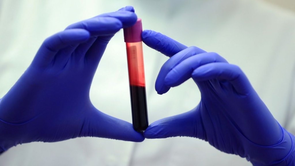 medical lab test