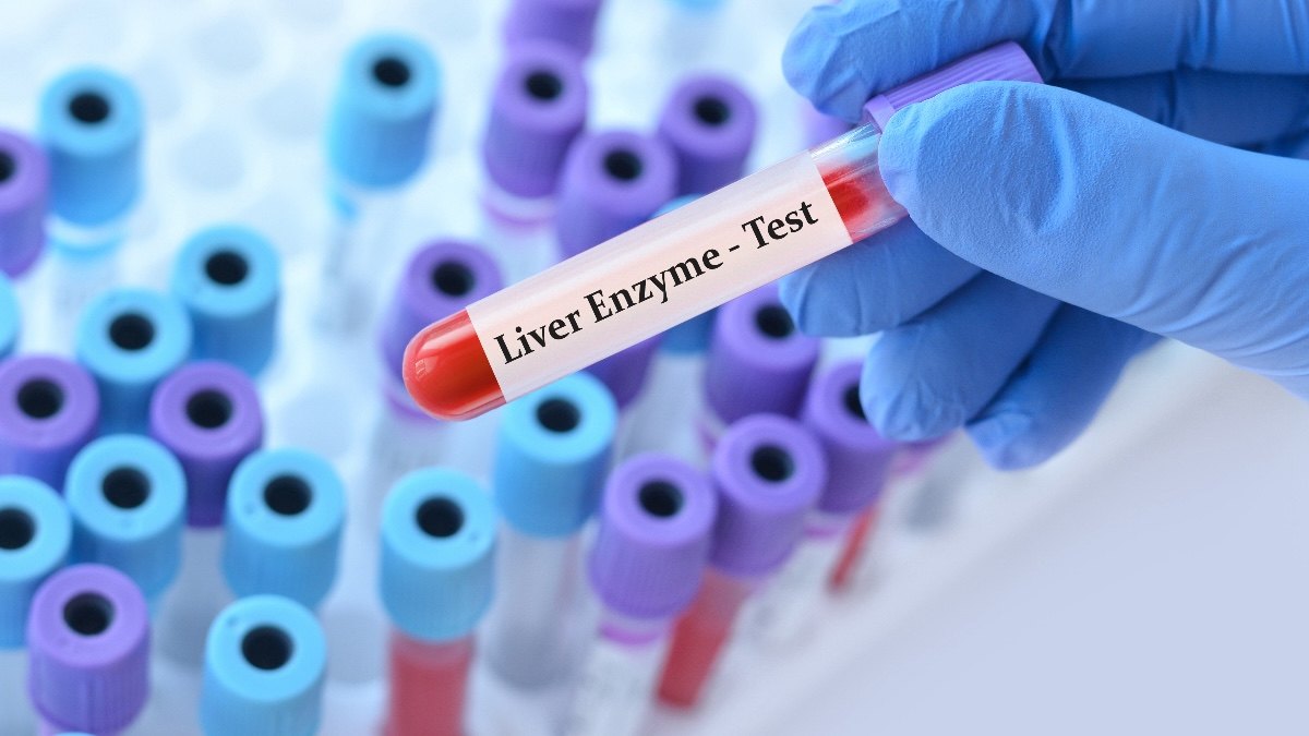 Ast Lab Values Normal AST Levels by Age and the Link To Fatty Liver Disease | Woman's ...