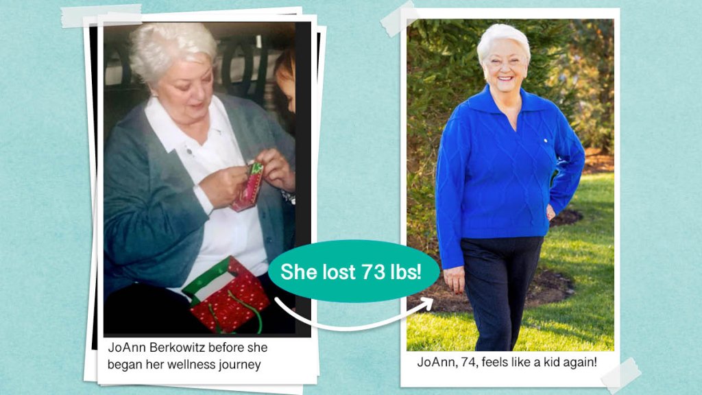 JoAnn Berkowitz before and after losing 73 pounds