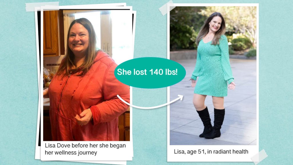 Lisa Dove before and after losing 140 pounds