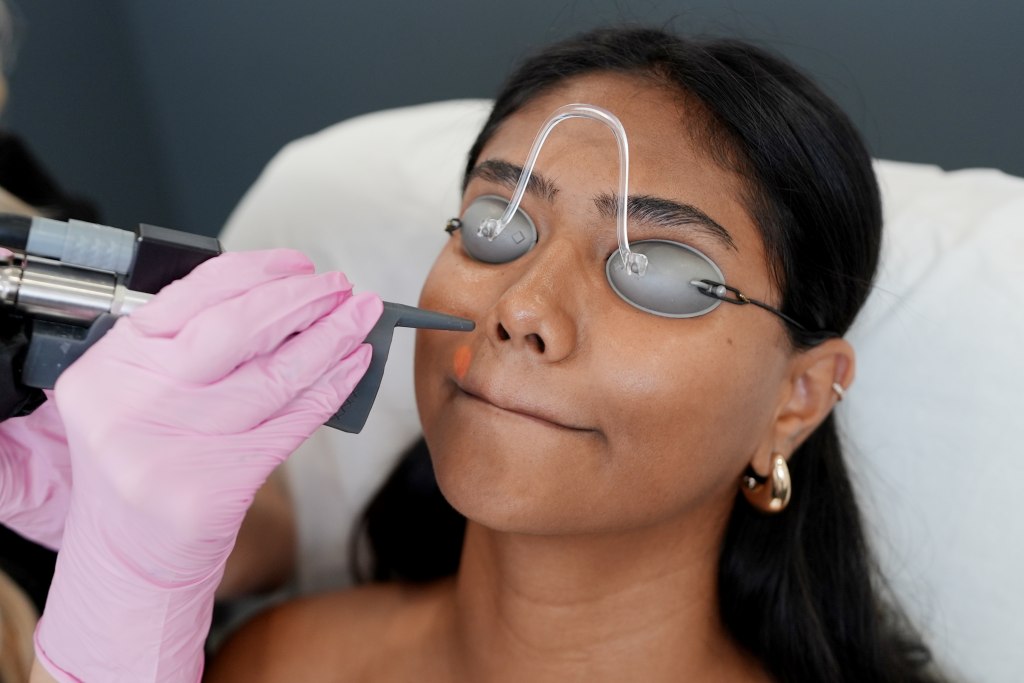 LaserHairRemovalLipTreatment