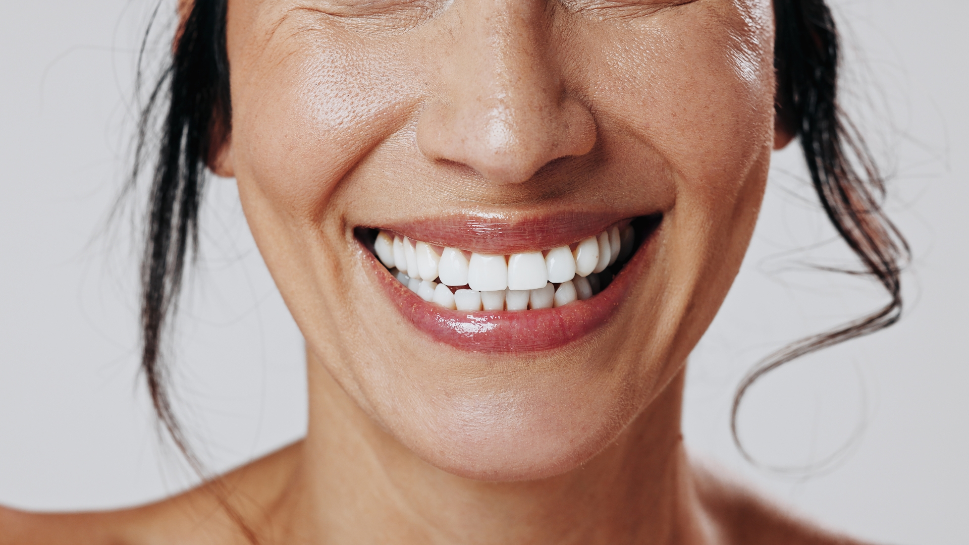 At-home teeth whitening kits offer a convenient way to brighten your smile before summer events.