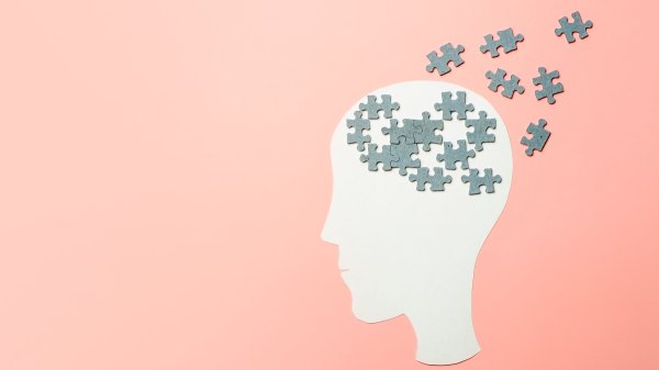 An illustration of a brain with missing puzzle pieces, representing Alzheimer's disease