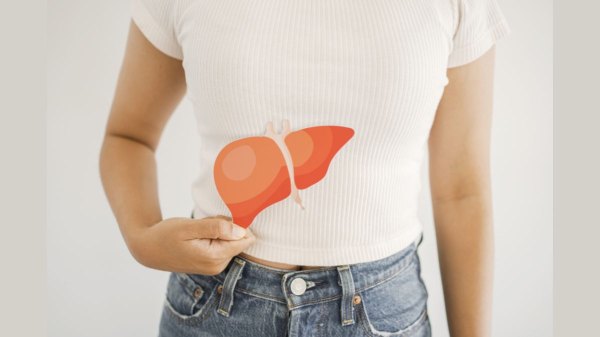 A woman holds a paper model of a liver in front of her belly to illustrate fatty liver disease