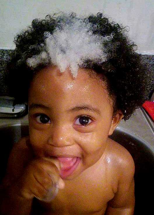 baby with hair streak